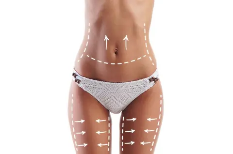 Chirurgie esthétique : pourquoi opter pour la liposuccion en Tunisie ?